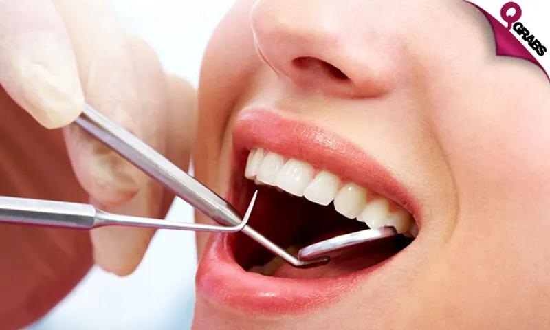 Teeth Scaling + Polishing + Consultation!